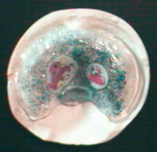 Gaumenplatte Überblick