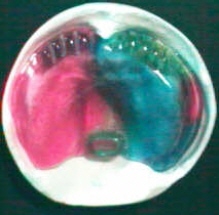 Gaumenplatte mit Napf und Rillen, zahnloser Kiefer