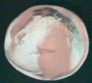 Gipsmodell im Dentallabor