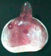 Herstellung des Individuallöffels