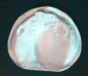 Neuer Abdruck mit Individuallöffel