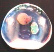 Fertige Gaumenplatte auf dem Modell